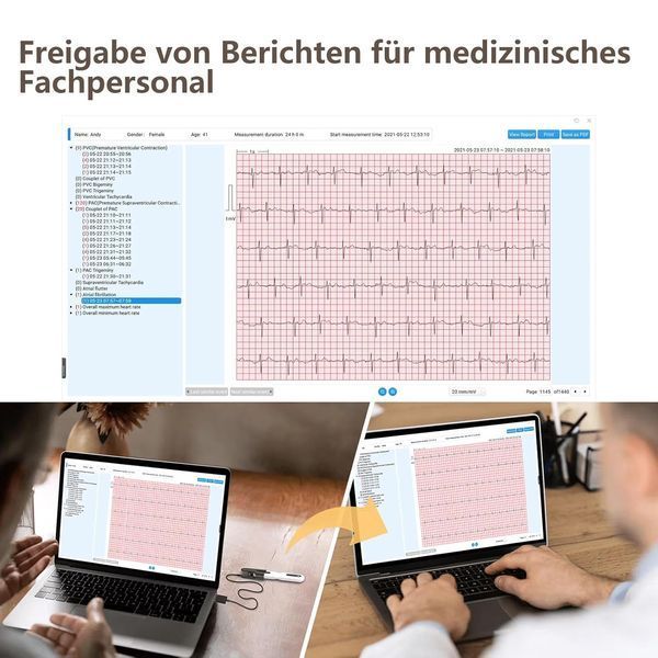 Цілодобовий монітор ЕКГ Wellue ER1-LW Dynamic ECG Recoder для дому