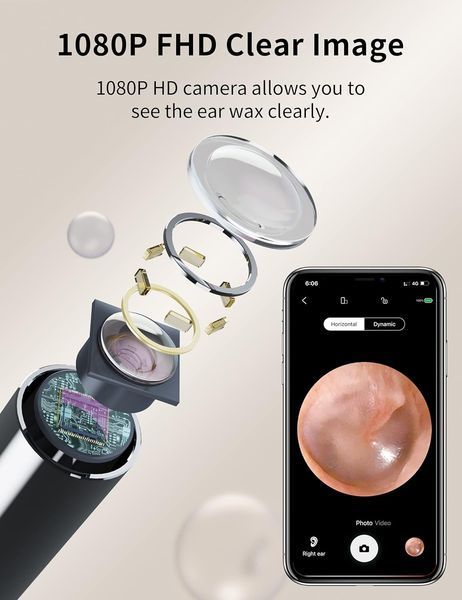 Отоскоп, набор для удаления ушной серы Hopefox 1080P WiFi