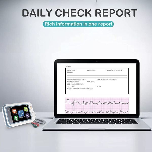 ЭКГ-монитор с пульсоксиметром ViATOM Checkme Lite Plus
